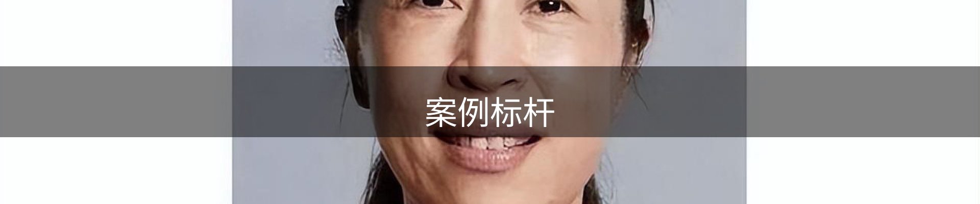 案例标杆